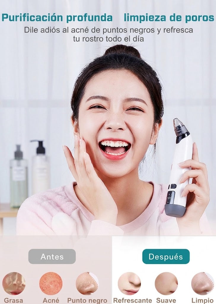 Limpiador eléctrico de poros y succionador de puntos negros con pantalla: Instrumento de belleza con nueva función de compresa caliente.